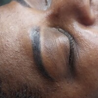 Micropigmentacão 