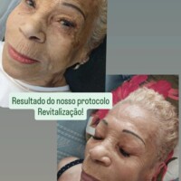 Limpeza de Pele